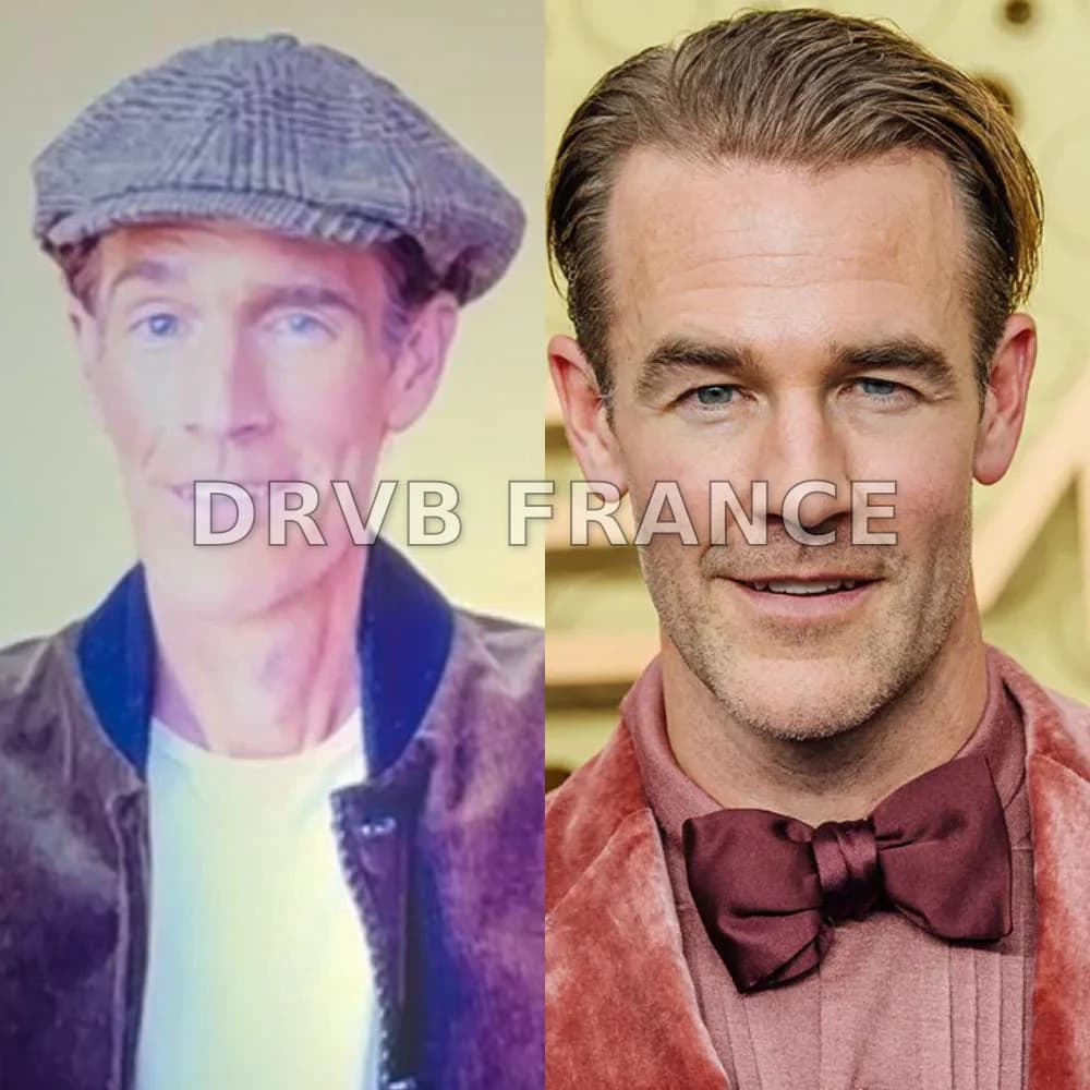 James Van Der Beek : Une leçon de courage face à la maladie