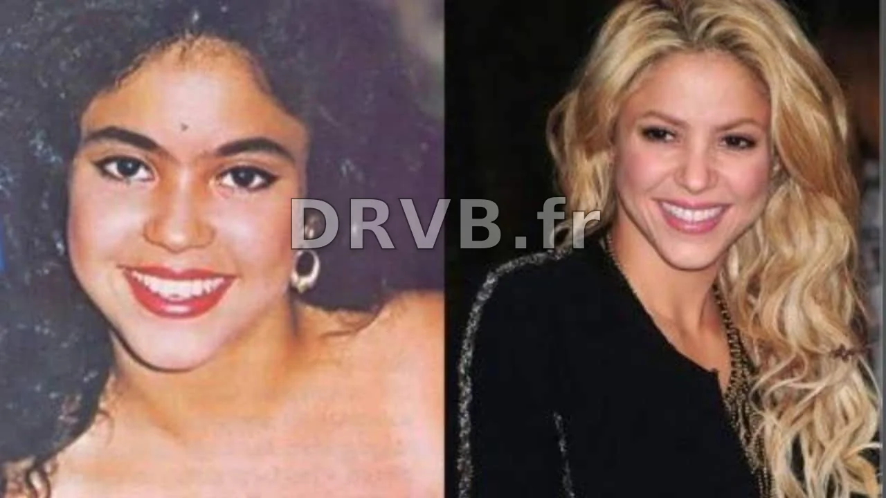 La Vérité sur la Chirurgie Esthétique de Shakira : Transformations et Rumeurs