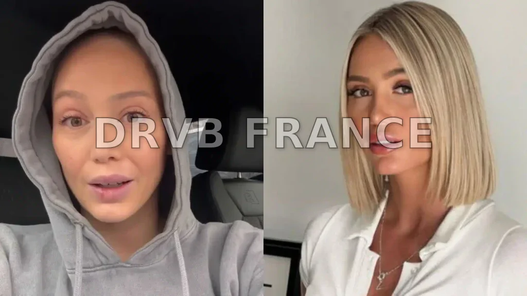 Eloise Appellee Avant Chirurgie: Une Figure Incontournable Avant et ...